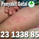 Illustration for article titled Macam-Macam Obat Gatal Kudis Gudik Paling Ampuh Di Apotik Umum
